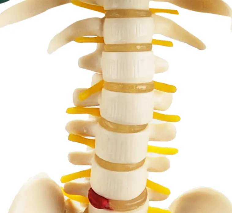 Anatomisch Skelet | 85 cm | Met zenuwwortels, halsslagaders en herniaschijf | Budget model, foto 6 van 6