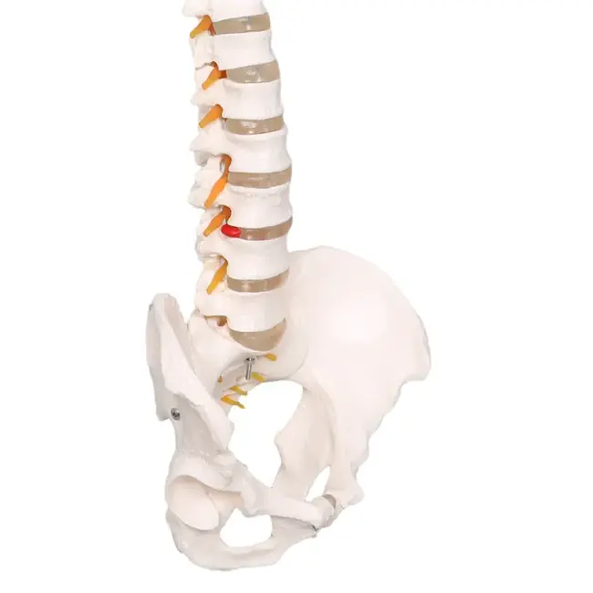 Anatomisch Wervelkolommodel met Bekken & Hernia – Levensgroot | 85cm