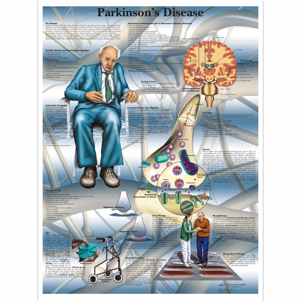 3B Poster De Ziekte van Parkinson | Engelstalig