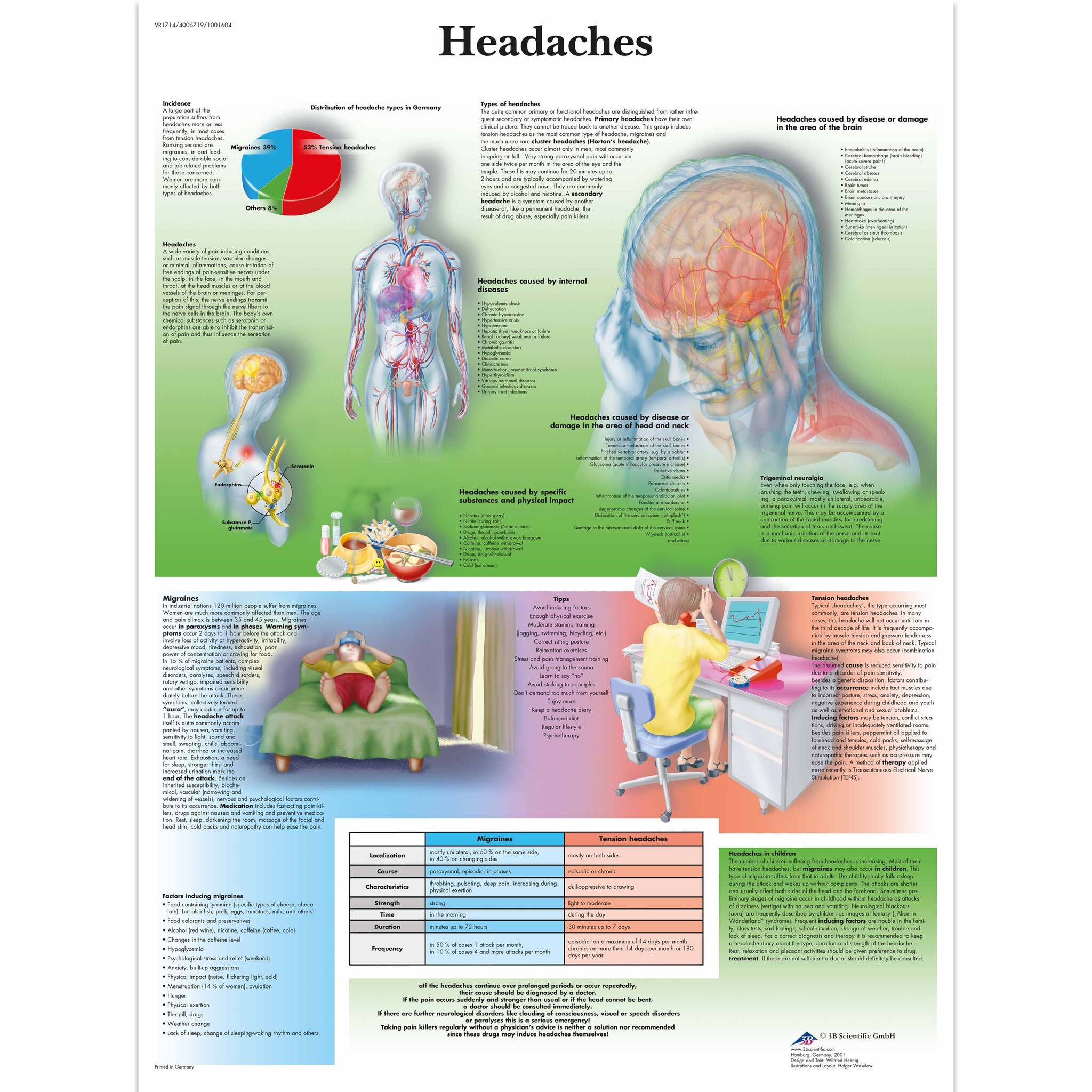 3B Poster Hoofdpijn / Migraine | Engelstalig