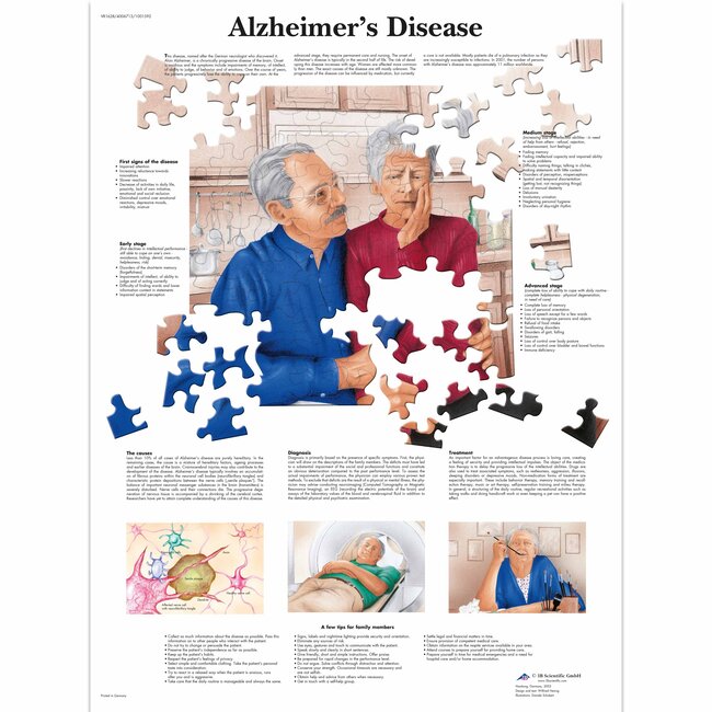3B Poster | De ziekte van Alzheimer | Engelstalig