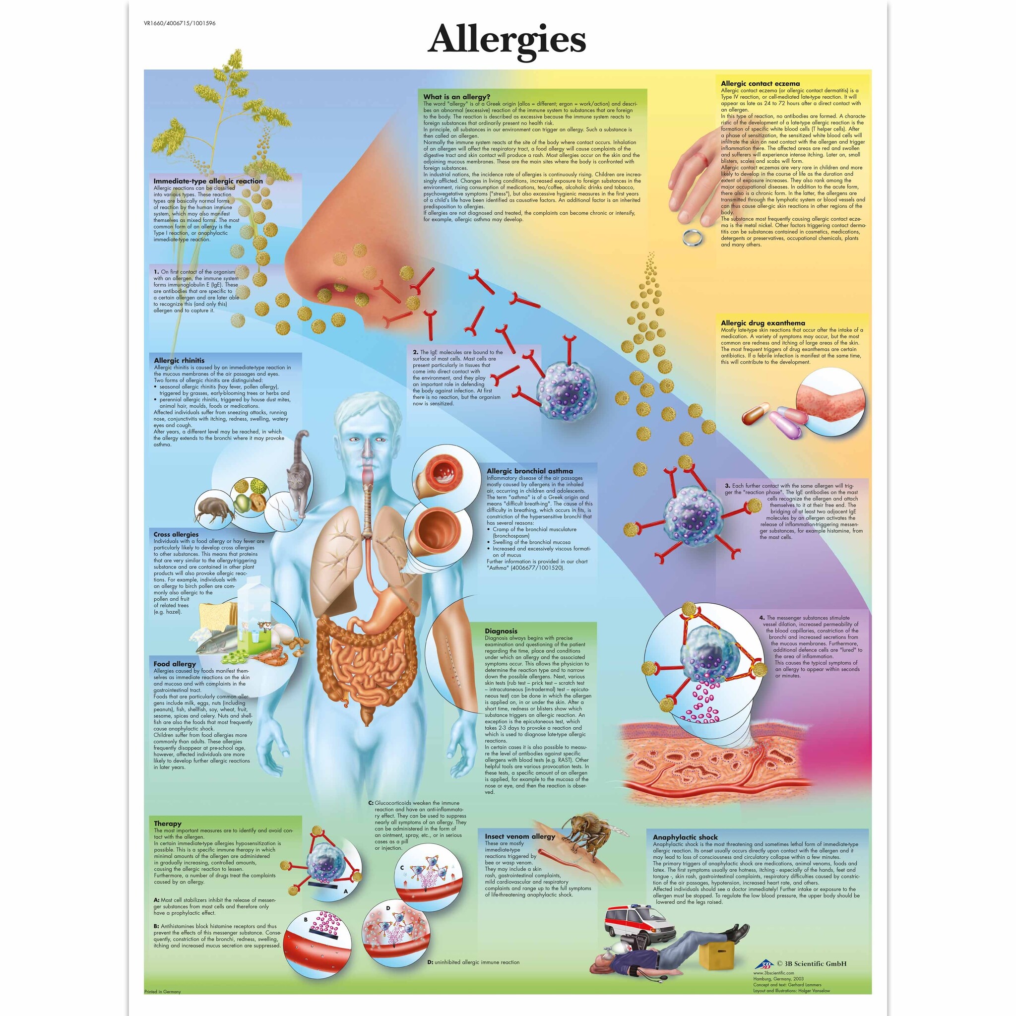 3B Poster Allergieën | Engelstalig