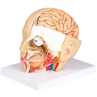 Erler Zimmer Hoofdmodel, 4 delen