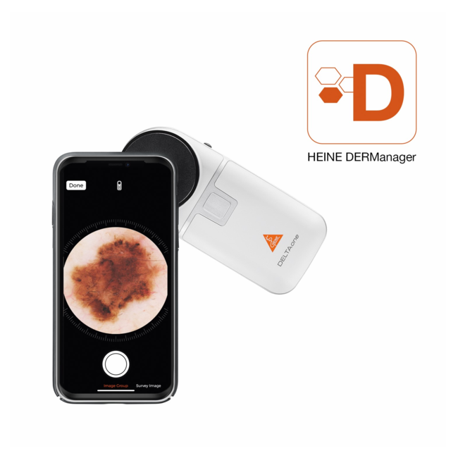 Heine DELTAone Dermatoscoop White - LED HQ & Gepolariseerd Licht