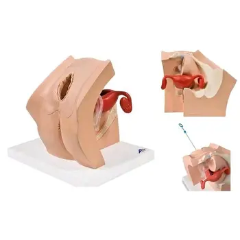Gynaecologie 