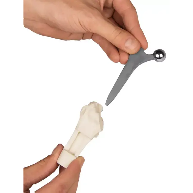 Erler Zimmer Heupimplantaat - Heupprothesemodel