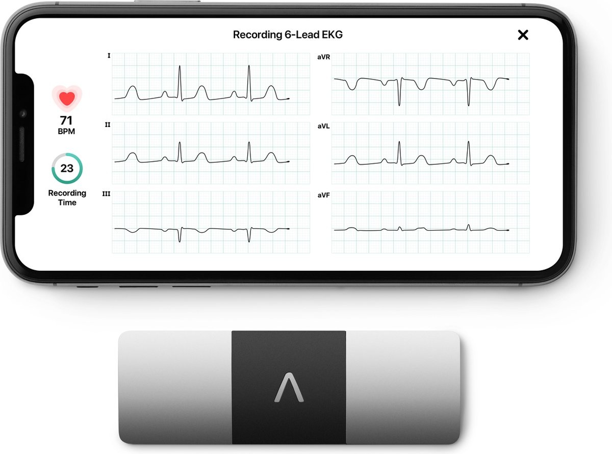 AliveCor Kardia Mobile 6L ECG