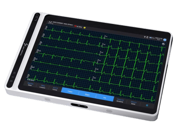LEPU Medical S120 – 12-kanaals draagbaar ECG - Incl.draagtas