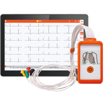 ECG apparaten en toebehoren
