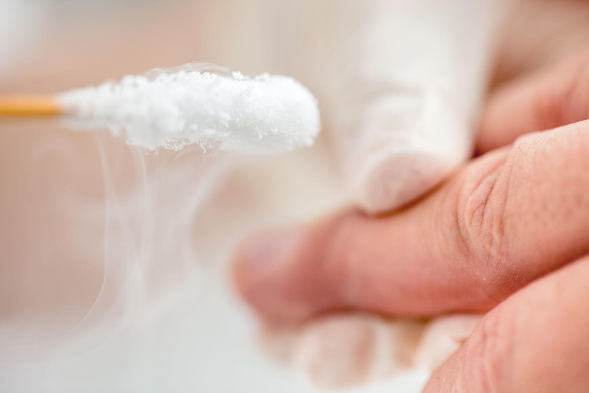Cryotherapie apparatuur voor wratten, fibromen en huidlaesies