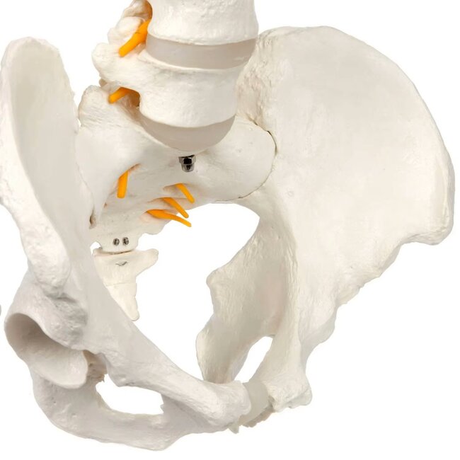 Anatomisch Wervelkolommodel met Bekken & Hernia – Levensgroot | 85cm
