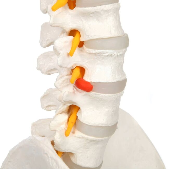 Anatomisch Wervelkolommodel met Bekken & Hernia – Levensgroot | 85cm
