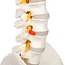 Anatomisch Wervelkolommodel met Bekken & Hernia – Levensgroot | 85cm