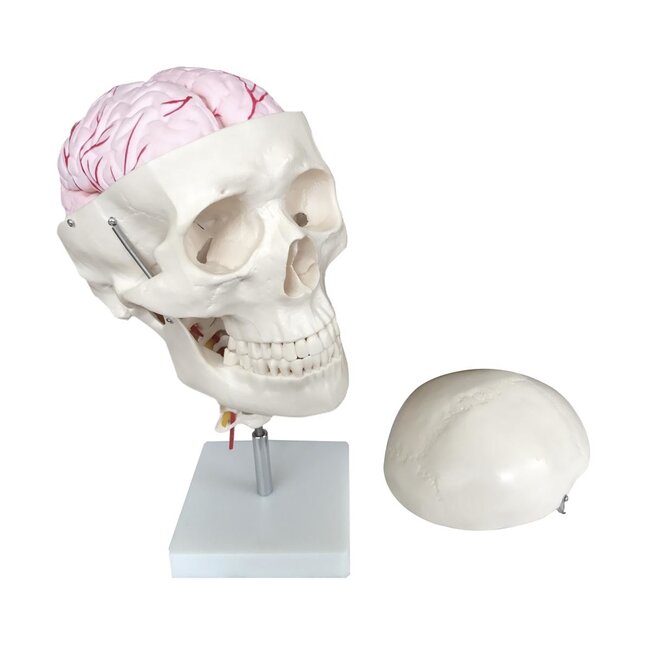 Anatomisch Schedelmodel met 8-delig Brein en Nekwervels