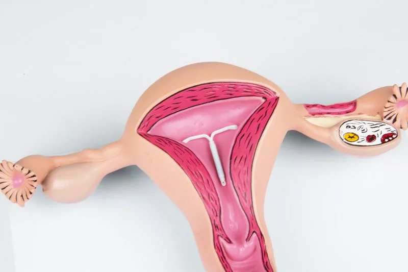 Erler Zimmer Anatomisch model van een gezonde baarmoeder, foto 2 van 4