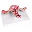 Erler Zimmer Anatomisch model van de baarmoeder met ziekten
