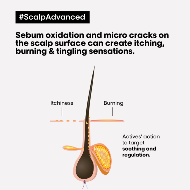 L’Oréal Professionnel - Scalp Advanced - Anti Discomfort | Shampoo voor de gevoelige hoofdhuid - 1500 ml.