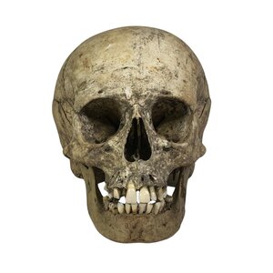 Human skull (B)