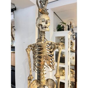 Skelet van een mens