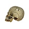 Human skull (C)