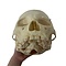Human skull (B)
