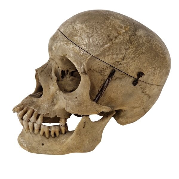 Human skull (A)