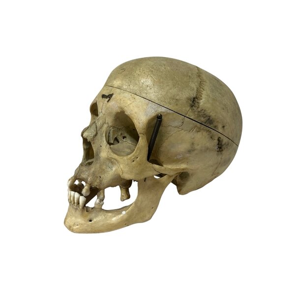 Menschlichen Schädel (B)