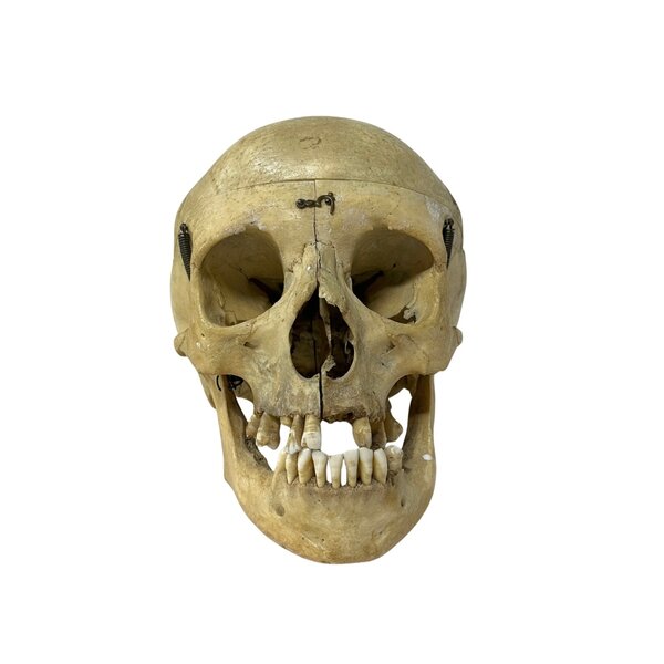 Menschlichen Schädel (B)