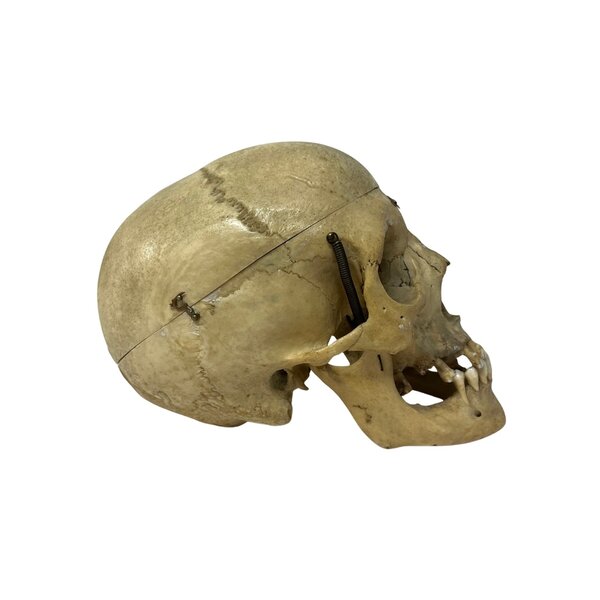 Human skull (B)