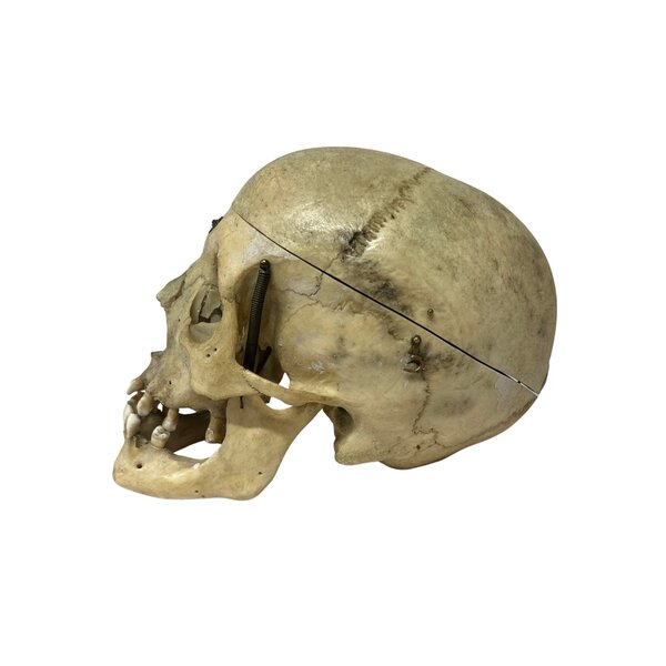 Human skull (B)
