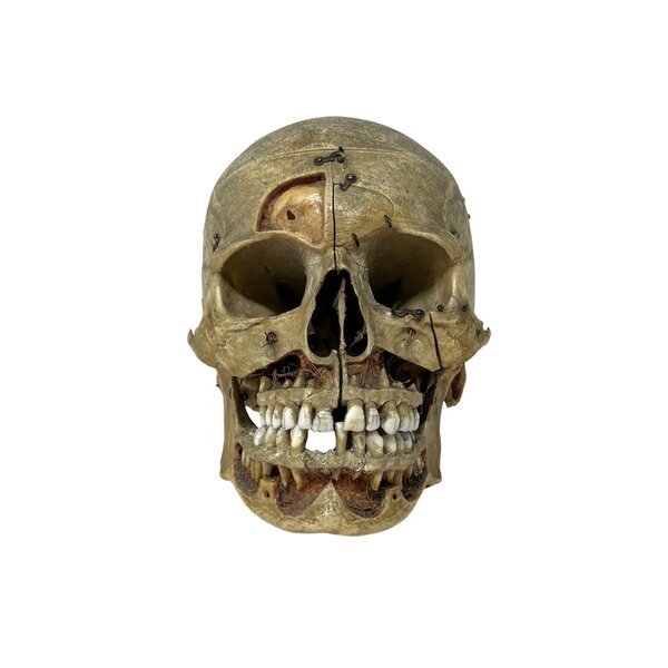 Human skull (C)
