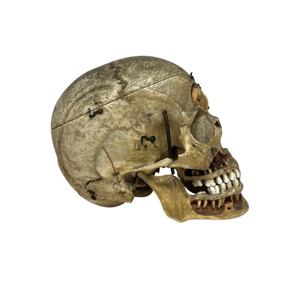 Human skull (C)