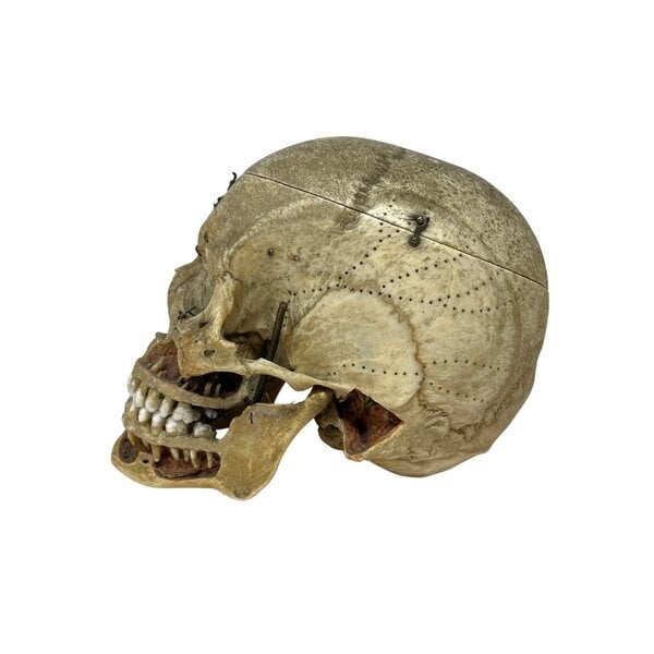 Human skull (C)