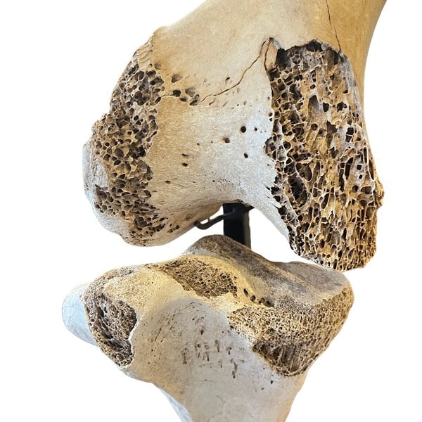 Bein eines Elefantenvogels (Aepyornis maximus)