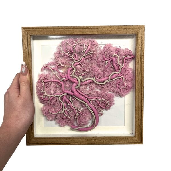 Placenta in frame (Pink)