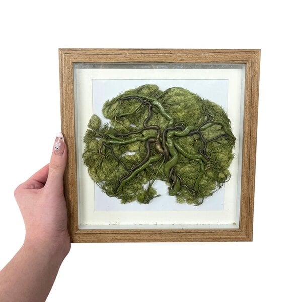 Placenta in frame (Green)