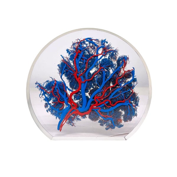 Placenta (Blue)
