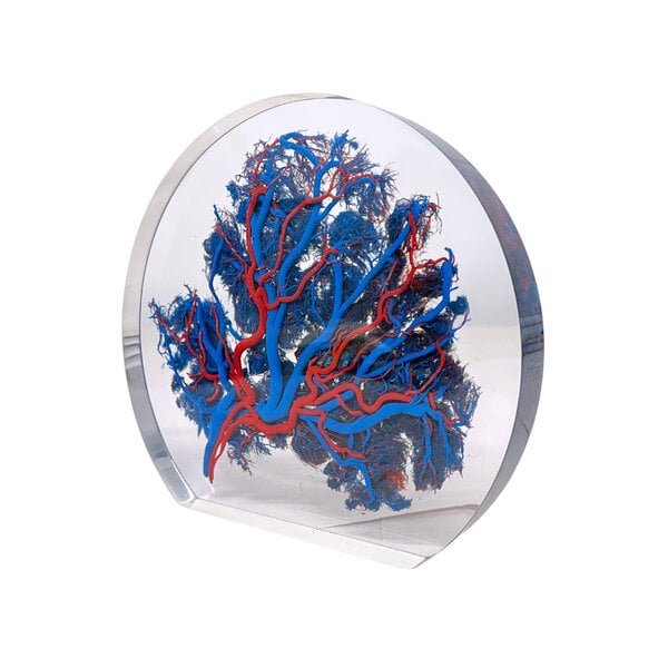 Placenta (Blue)
