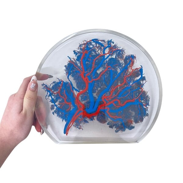 Placenta (Blue)