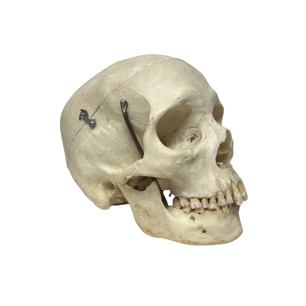 Schedel mens (B)
