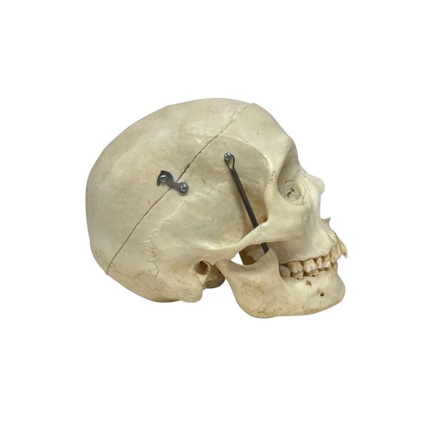 Human skull (B)