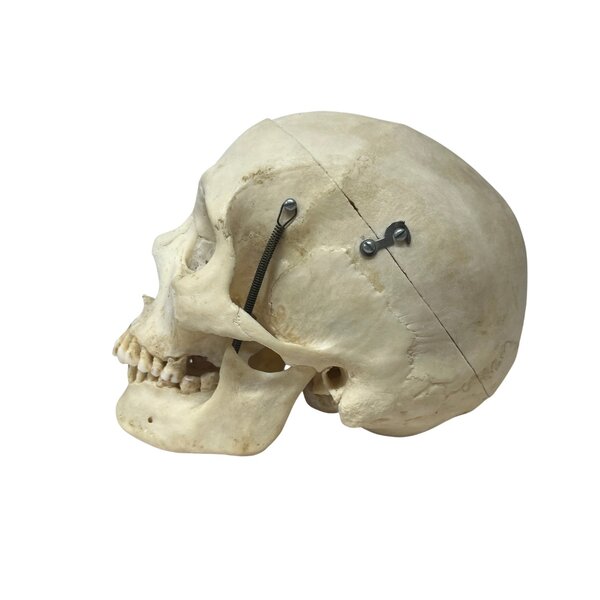 Human skull (B)