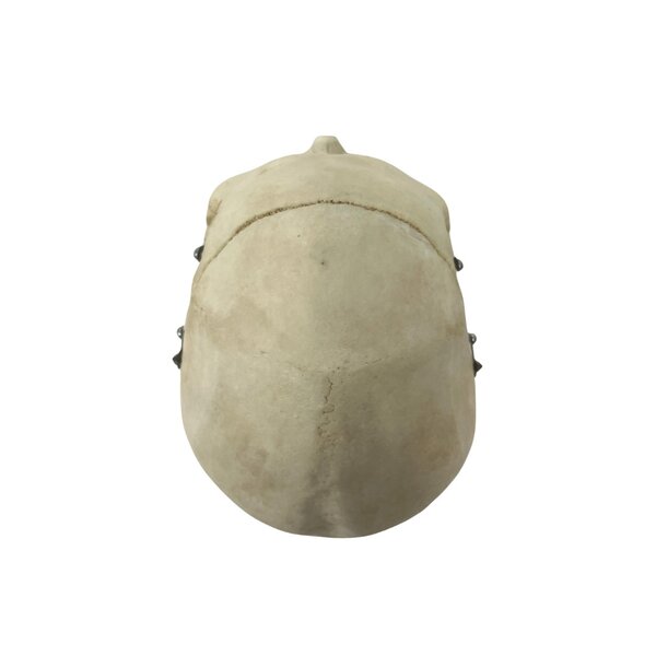 Human skull (B)