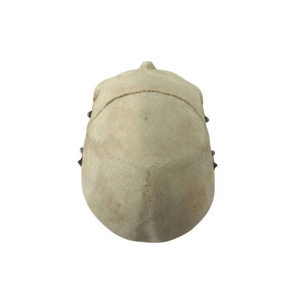 Schedel mens (B)