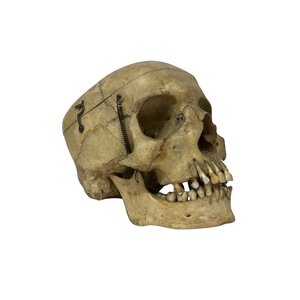 Human skull (A)