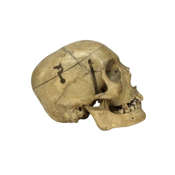 Human skull (A)