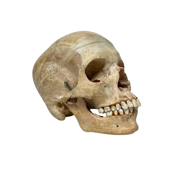Schedel mens (D)