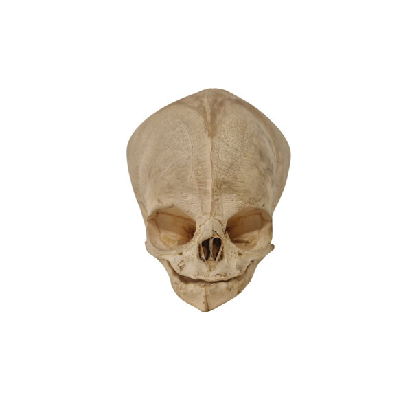Human Baby skull