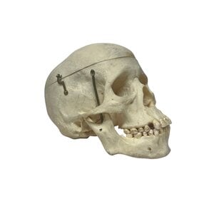 Human skull (B)