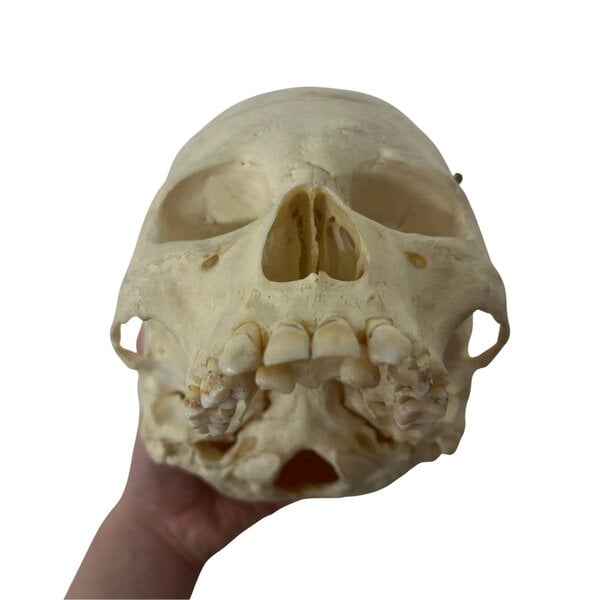 Human skull (B)